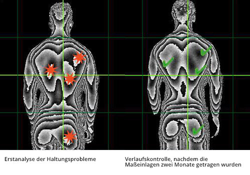 Bild der 3D Haltungsanalyse